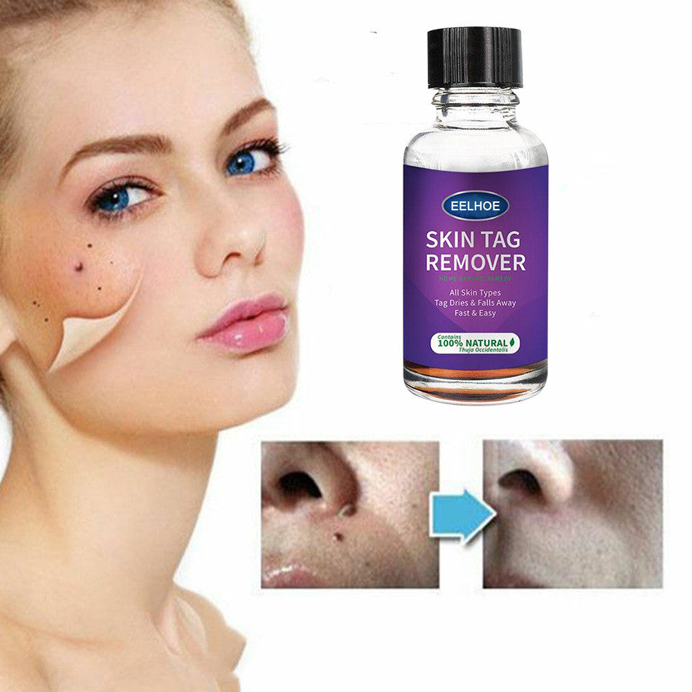 Foreign Trade Cross-Border Eelhoe Skin Verrucous Remover To Solve Skin Verrucous