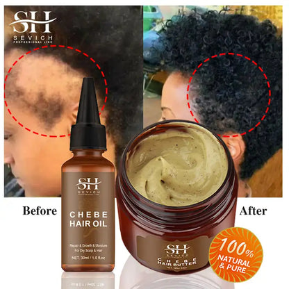 Chebe Traction Alopecia Thicken Oil Anti Hair Loss Treatment