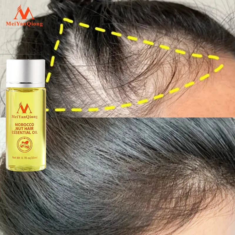 Hair Care Oil Prevents Hair Loss Promotes Hair Loss Growth